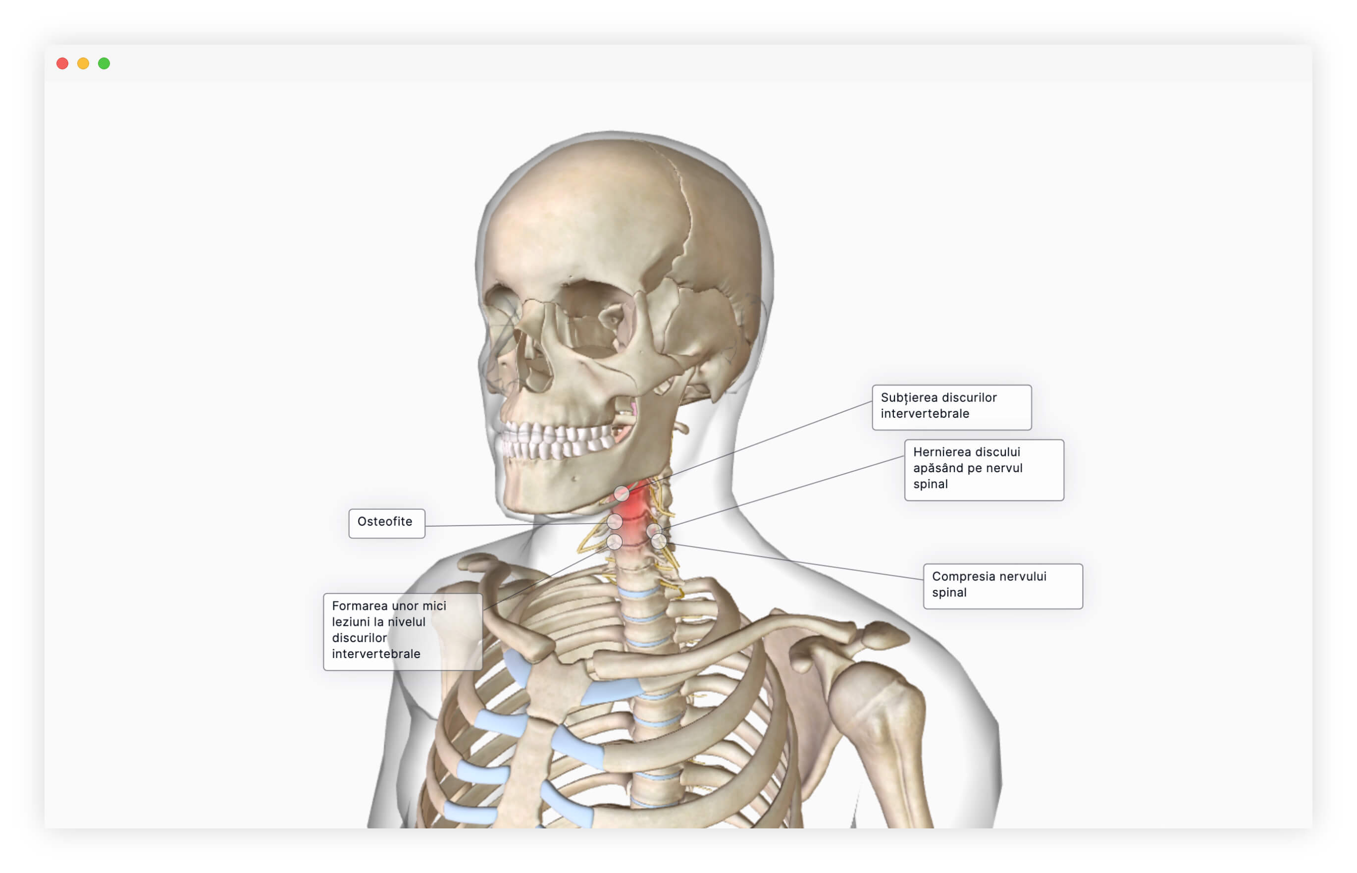 model anatomic